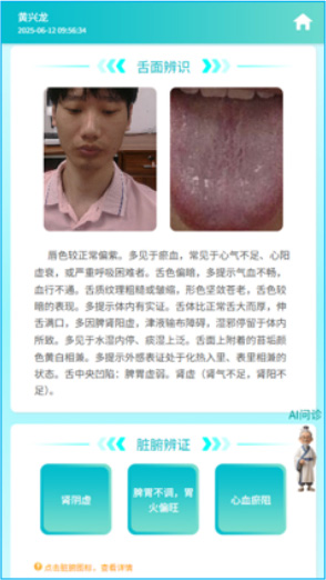 舌面辨识